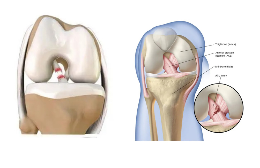 Computer Assisted Surgery
